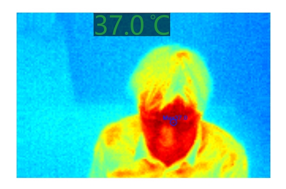 infraSpector thermal entry screening image